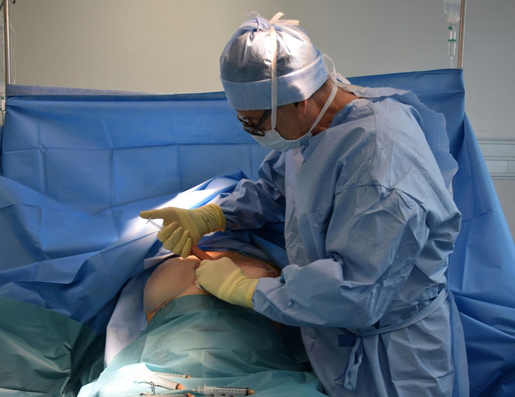 BBL surgery