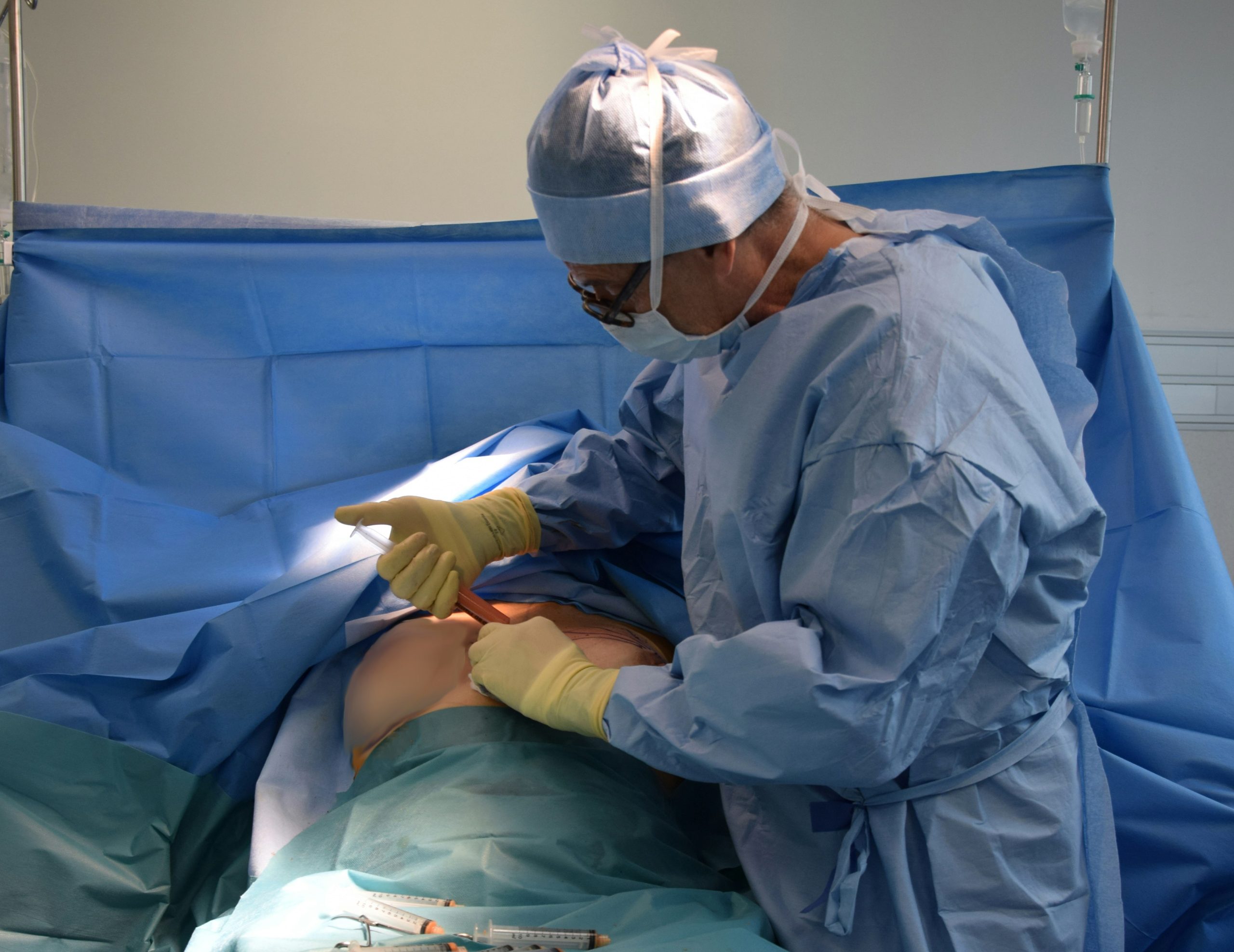 BBL surgery