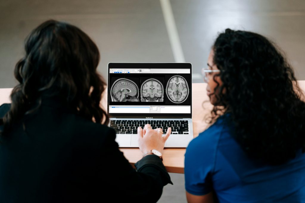 autism spectrum disorder brain connectivity research illustration