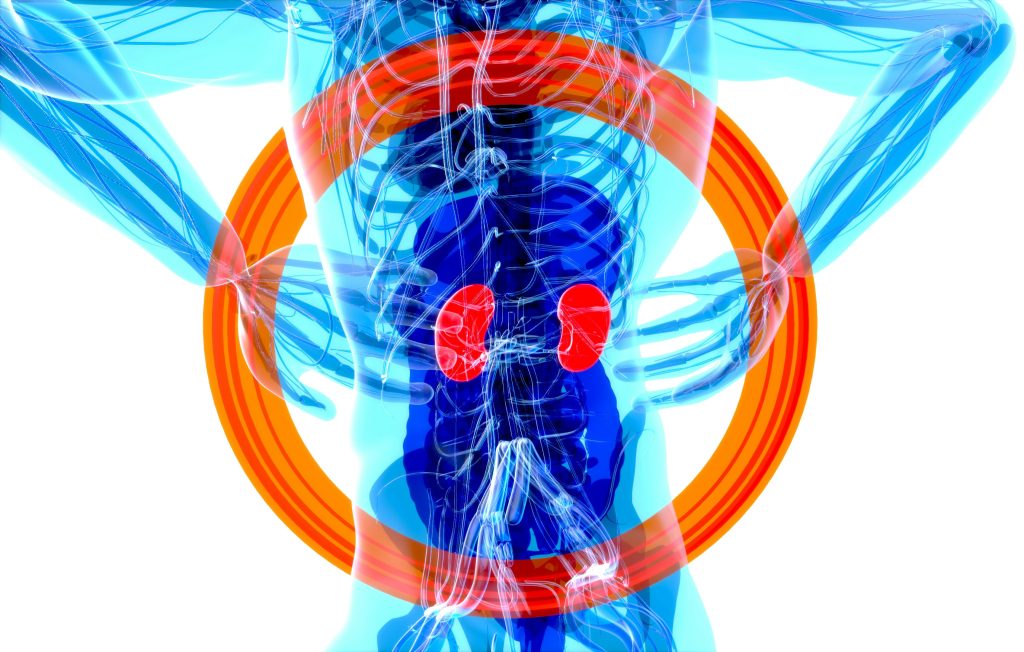 colorectal cancer young adults