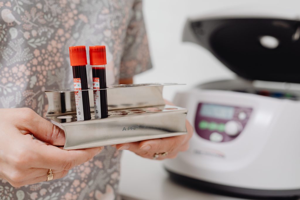 Blood test report for hs-CRP and cholesterol levels